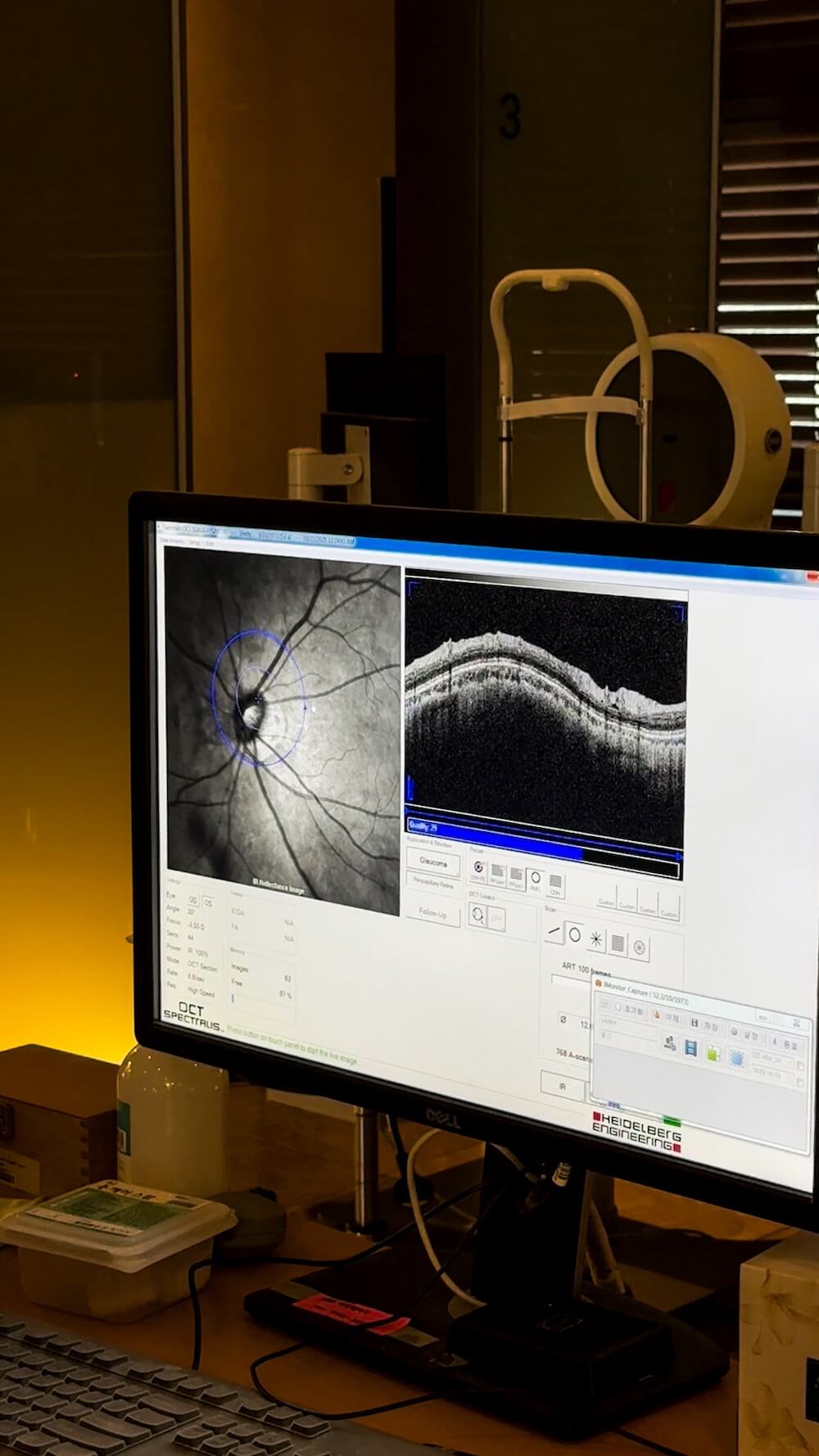 Bright Eye Clinic in Seoul | Vision Correction in Korea for Foreigners you can Trust 24 eye exam at bright eye clinic in seoul