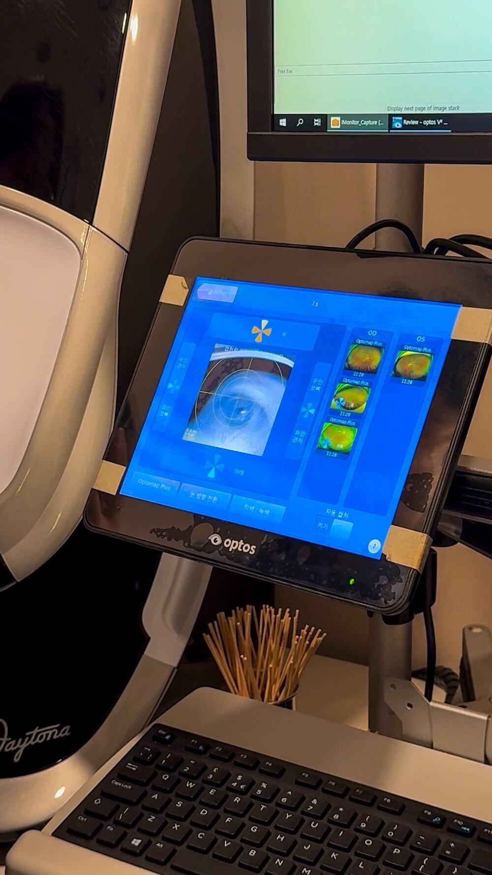 Bright Eye Clinic in Seoul | Vision Correction in Korea for Foreigners you can Trust 19 eye exam at bright eye clinic in seoul