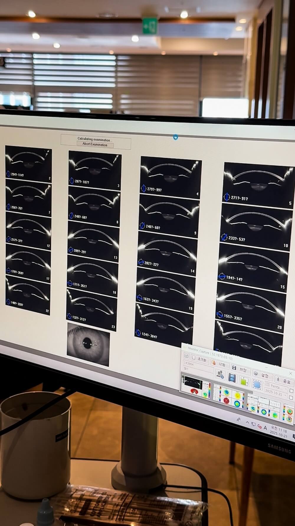 Bright Eye Clinic in Seoul | Vision Correction in Korea for Foreigners you can Trust 8 bright eye clinic in seoul diagnostic exams