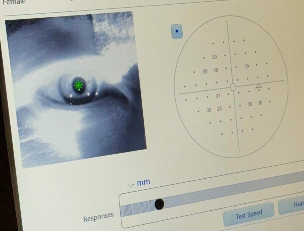 Bright Eye Clinic in Seoul | Vision Correction in Korea for Foreigners you can Trust 27 eye exam at bright eye clinic in seoul