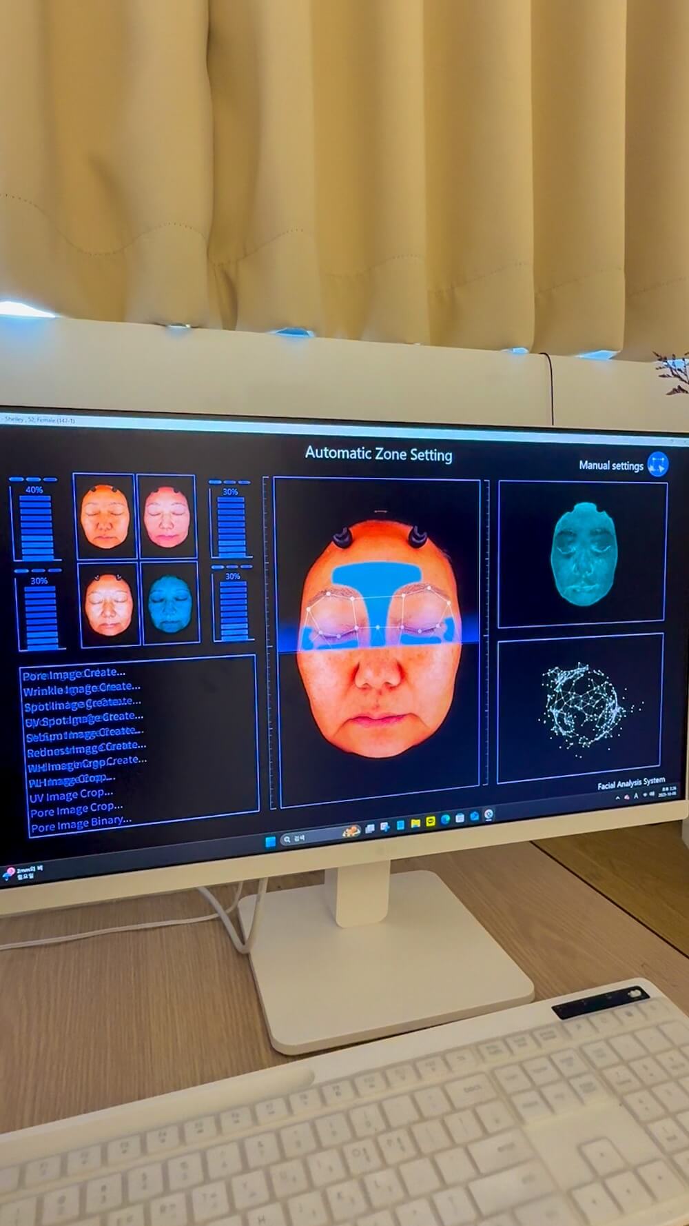 How to Save on Skin Treatments in Korea | Insights From Trying Over 20 Seoul Beauty Clinics Myself 19 skin analysis at a skin clinic in seoul