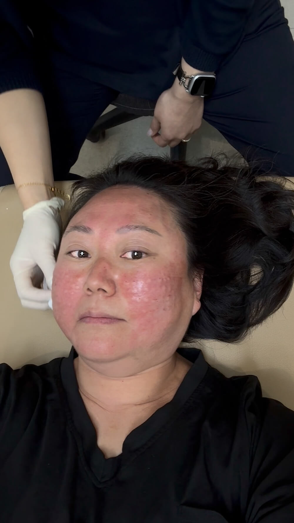 How to Save on Skin Treatments in Korea | Insights From Trying Over 20 Seoul Beauty Clinics Myself 12 skin treatments in seoul | rejuran injections at xenia clinic