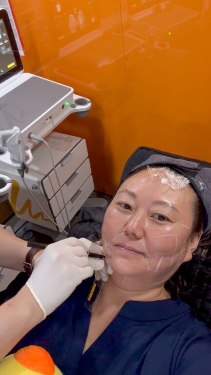 facial treatments in korea | ultherapy prime