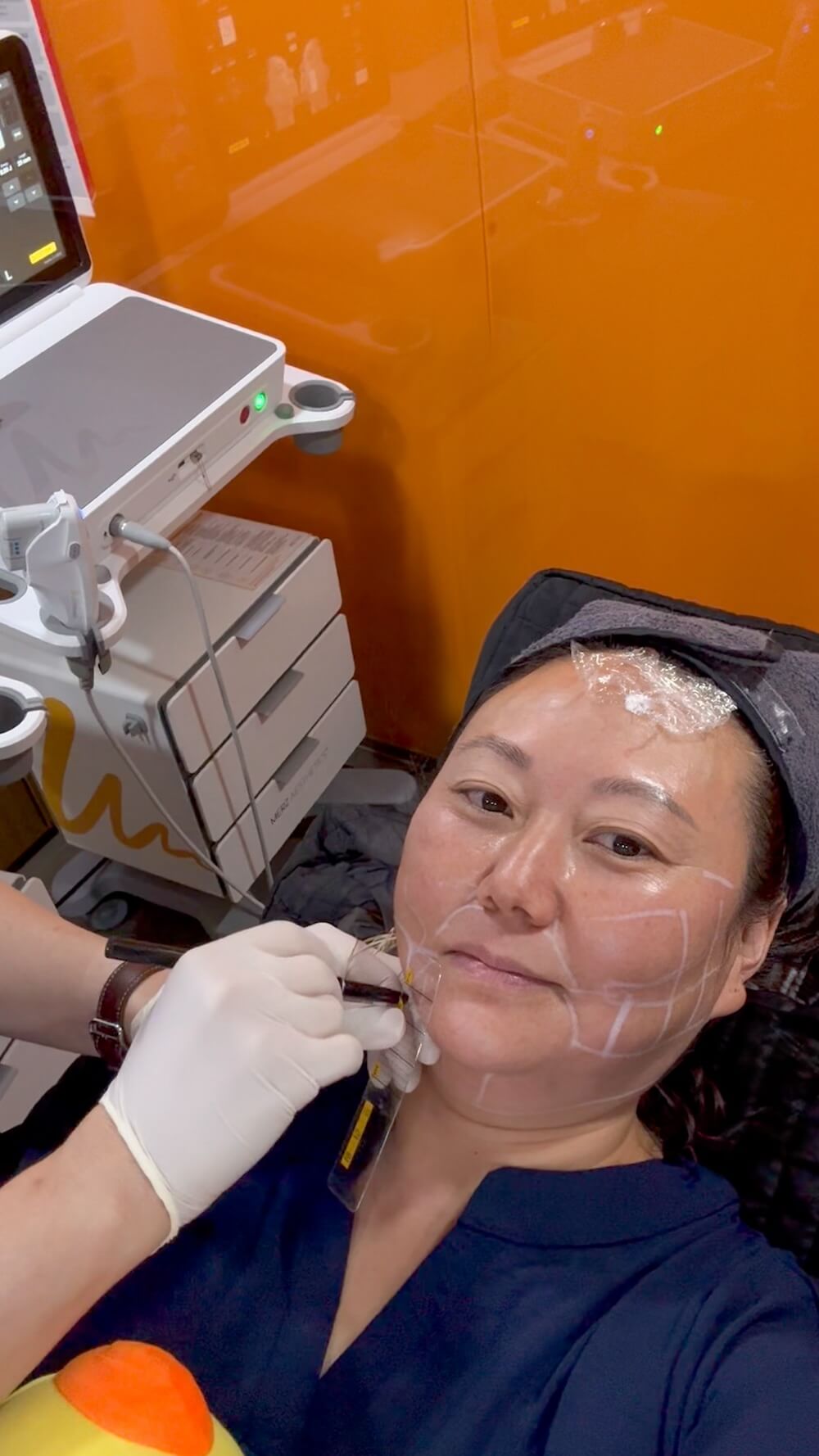 How to Save on Skin Treatments in Korea | Insights From Trying Over 20 Seoul Beauty Clinics Myself 10 facial treatments in korea | ultherapy prime