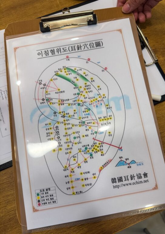 reflex points on the ear seeding map