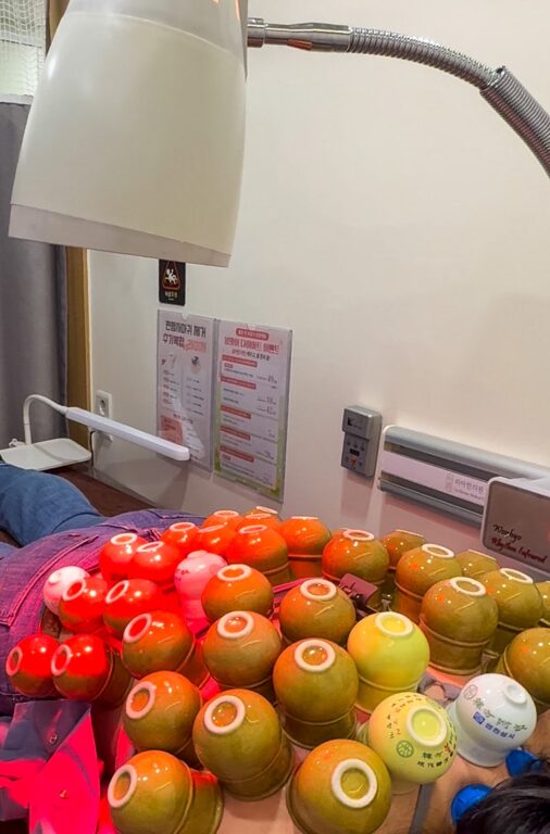 traditional korean fire cupping in seoul