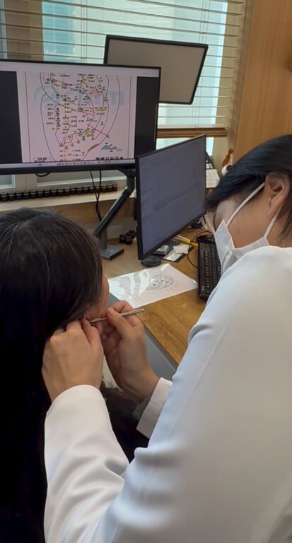 ear seeding therapy in seoul